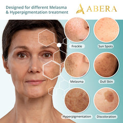 ABERA Melasma Serum Plus—application matin et soir sur le visage.