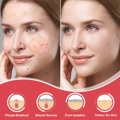 AcneGo patches adhèrent durablement au visage pendant la nuit.