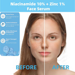 AFCRYIYE Niacinamide 10% + Zinc 1% – goutte, application rapide pour peau uniforme.
