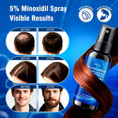 AMRWRIR Application cuir-chevelu: massage favorise absorption.
