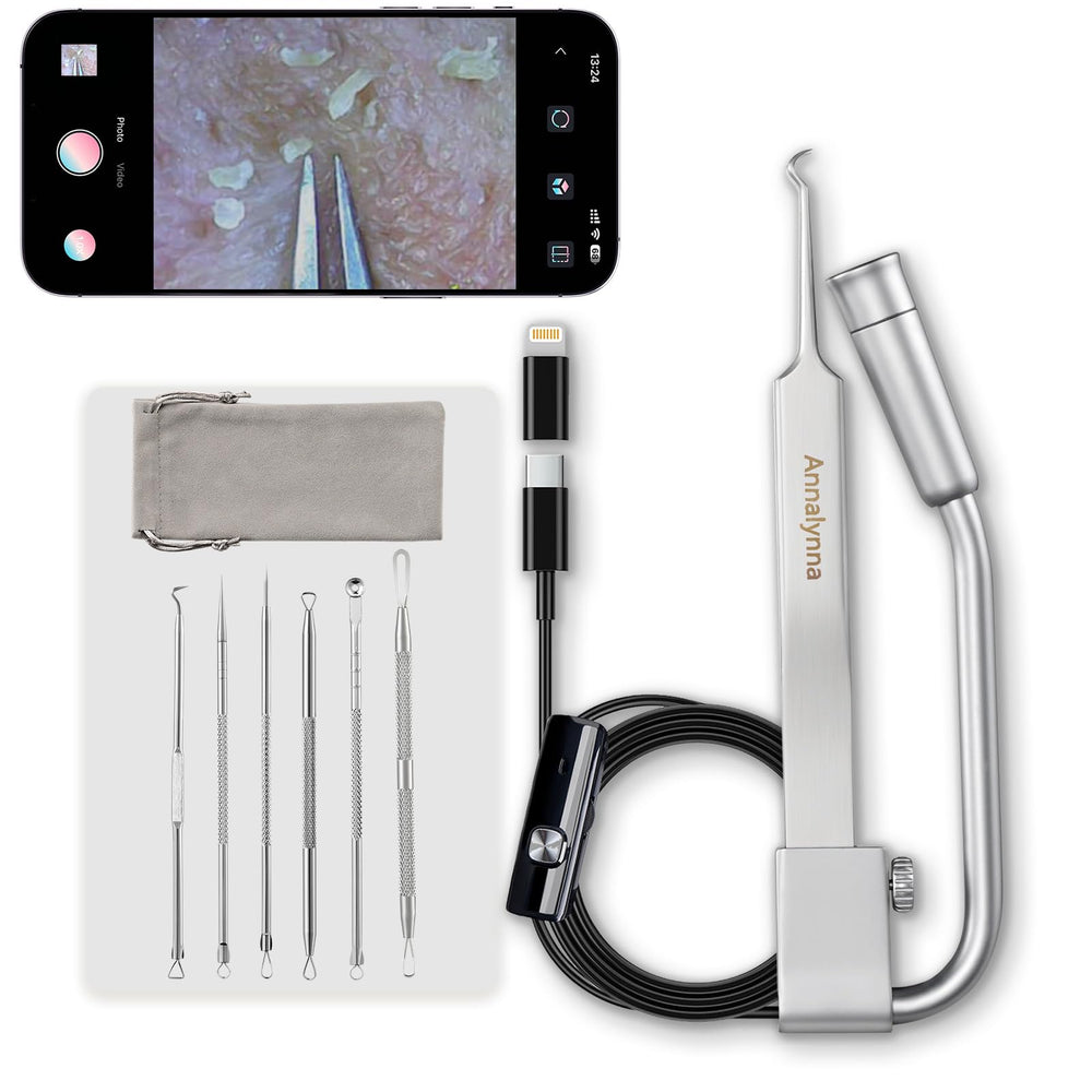 Annalynna Luma 1 caméra 1080p pour inspecter les pores avec précision.