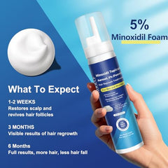 AOOLCF Minoxidil : application quotidienne facile pour une croissance capillaire potentielle