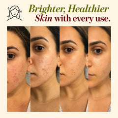 Aqia Organics Poudre détox pores — purifie les pores et clarifie le teint.