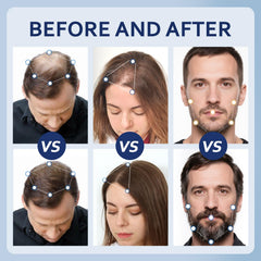 Artimore Minoxidil cheveux visiblement plus denses après utilisation.