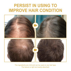 Axnzp formule naturelle avec plus de 10 huiles pour nourrir les cheveux.