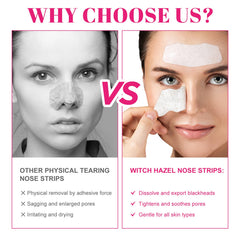 Bandes nez charbon naturel — application sur le nez pour capturer les impuretés.