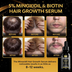Beaueli sérum biotine pour cheveux et barbe, nourrissant et densifiant.