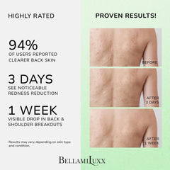 BellamiLuxx Bacne Spray Brume Fin: application uniforme sur le torse et les épaules.