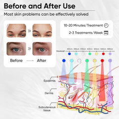 Beuwe masque LED sécurité et confort adaptés à tous types de peau