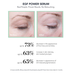 Bioeffect EGF Puissant Sérum – flacon KGf, soutien potentiel à la fermeté