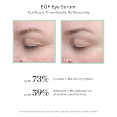 Flacon de 6 mL BIOEFFECT EGF prêt à hydrater le contour des yeux.