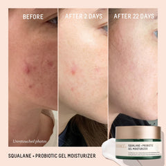 Biossance Texture Gel Léger Peau: absorption rapide et confort.