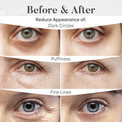 BLOOMORA patchs-yeux-poches-cernes-relaxation apportent une sensation rafraichissante et un regard plus lumineux.