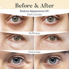 Patch BLOOMORA yeux, acide hyaluronique pour hydratation durable.