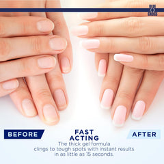 Blue Cross baie d’argousier — nourrit et hydrate cuticules et ongles.