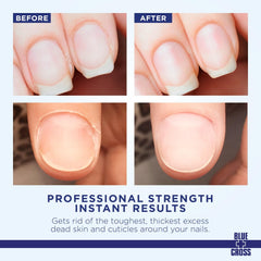Blue Cross Cuticle Remover liquid being applied to hands
