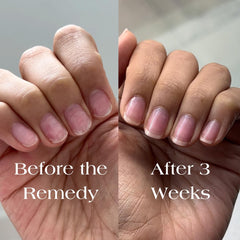 Botanist Nails Remedy texture rose lumineuse sur l’ongle.