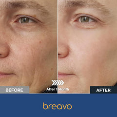 Breavo 6 en 1, ciblage des rides et peau plus lisse.