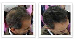 Caboki couleur Salt & Pepper-Dark adaptée aux cheveux gris et foncés