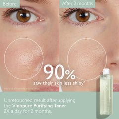 Caudalie Vinopure application sur coton : détox et réduction des brillances.