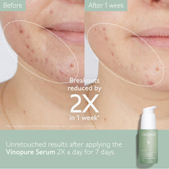 Caudalie Vinopure - utilisation matin pour peau nette et purifiée.
