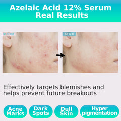 Sérum CELDYQUE avec tranexamique absorption rapide le matin.