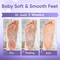 Résultats possibles: pieds plus lisses après utilisation.