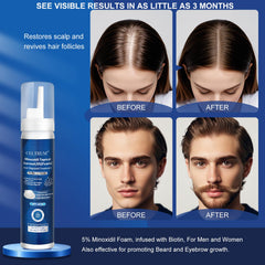 Celtrum Minoxidil Foam – routine capillaire simple et efficace.