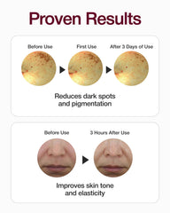 CENTELLian 24 Expert Madeca Mela Capture Ampoule Max, texture lactée légère offrant hydratation durable