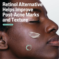 Sérum CETAPHIL Gentle Clear: texture légère et hydratante sur la peau.