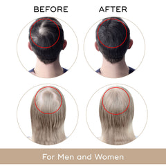 Charismo Dekohair Sérum - application sur le cuir chevelu: densité potentielle des cheveux.