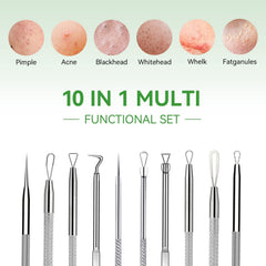 ChenYiJin outils extraction boutons; prise en main ergonomique pour un travail précis.