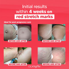 Cicatrissim Crème absorption rapide, application facile et non collante.