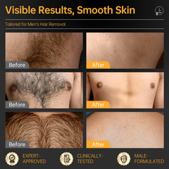 CKM Crème dépilatoire pour homme sur torse et dos, peau lisse après utilisation.