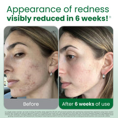 Clean Skin Club – serviettes-visage jetables infusées aloès et glycérine pour hydratation légère.