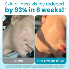 Texture exfoliante en points sur les lingettes Clean Skin Club