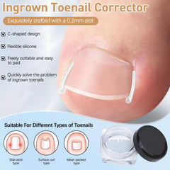 Correcteur d’ongle incarné – lift-ongle : soulagement potentiel et alignement des bords.
