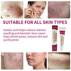 Crème acide azélaïque visage, emballage élégant