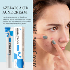 Crème Acide Azelaïque: pores affinés et peau plus lisse
