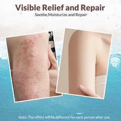 Crogooe eczema cream pump bottle for easy daily application