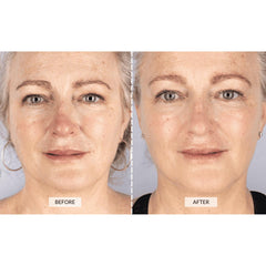 CurrentBody Masque LED: 132 diodes rouge et infrarouge pour une thérapie ciblée.