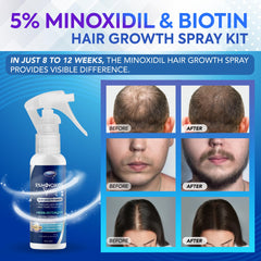 Dabida Minoxidil Spray, démonstration d'application précise sur le cuir chevelu.