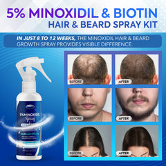 Vaporisateur DABIDA Minoxidil facilitant l'application quotidienne.