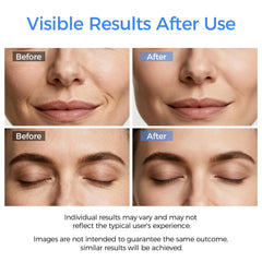 DABZAL nettoyeur-visage mode Ion Plus éliminant les impuretés