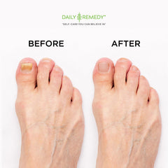 DAILY REMEDY foot soak ingredients highlight tea tree and essential oils.