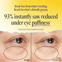 Patch hydrogel Derma E Yeux caféine pour décongestion matinale