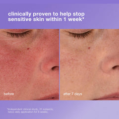 Dermalogica Crème Barrière Renforcée sur visage, protège peau sensible.
