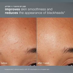 Dermalogica Daily Microfoliant mains mouillées démontrent l'application simple et rapide.