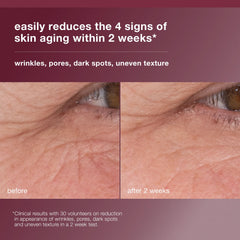 Dermalogica Dynamic Skin Retinol Serum — texture légère pour peau lissée au réveil.