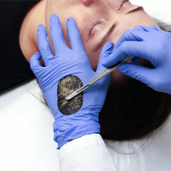 Dermapad: capture des poils velus pendant le soin.